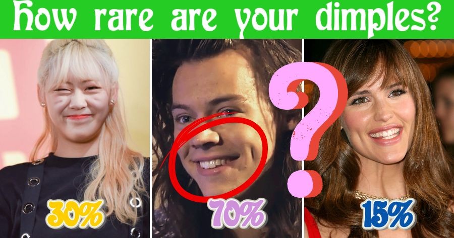 How Rare Are Your Dimples?